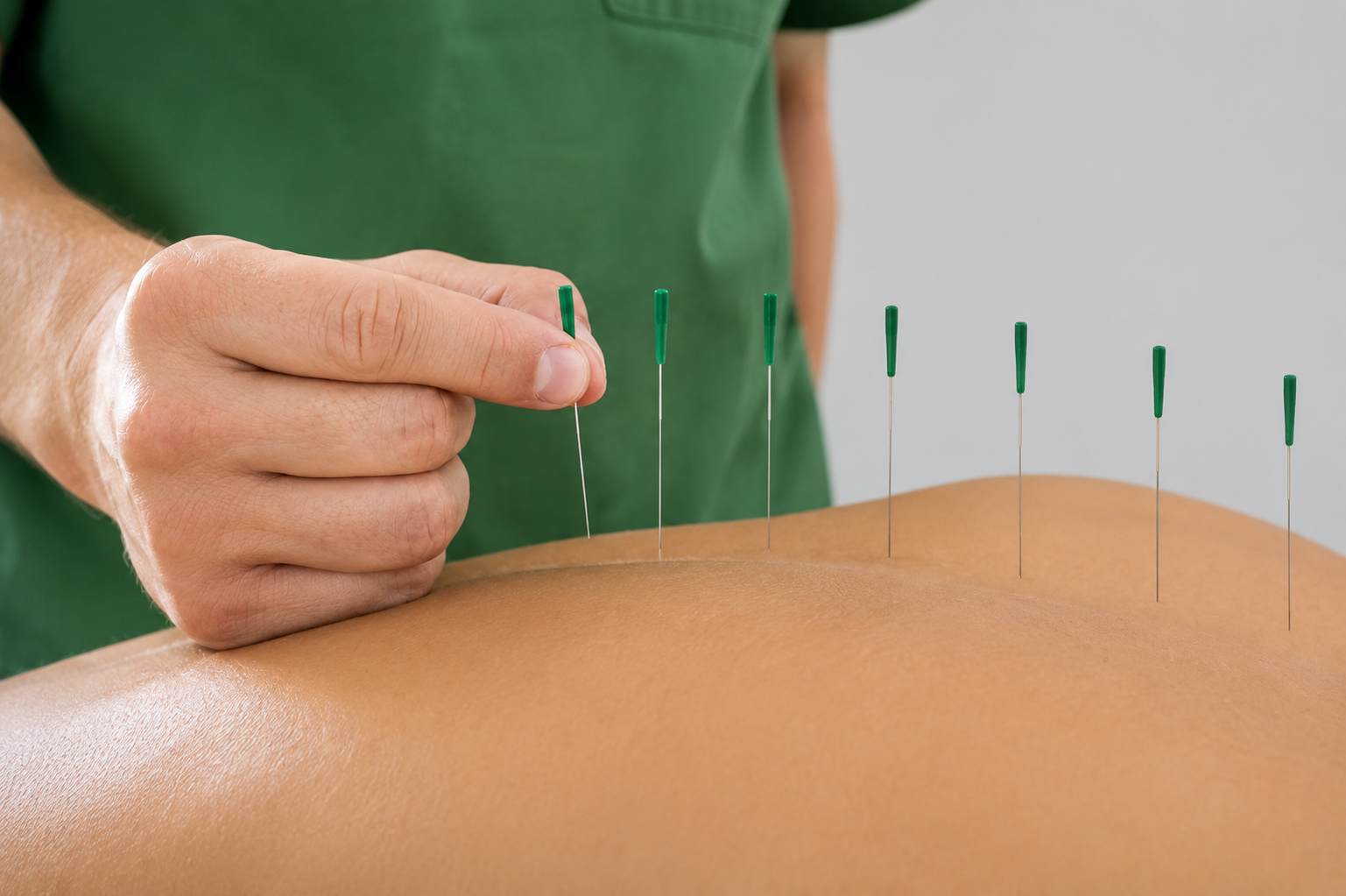 Dry Needling